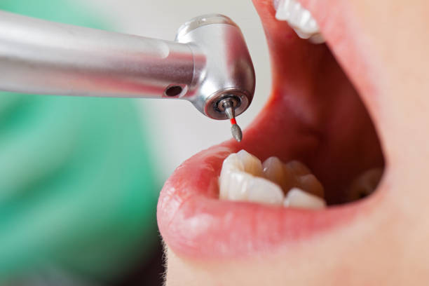Best Emergency Denture Repair in Grifton, NC